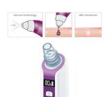 Beurer FC 41 Deep pore cleanser, vacuum technology, LCD display, 3 attachments, 5 speed levels, for all skin types